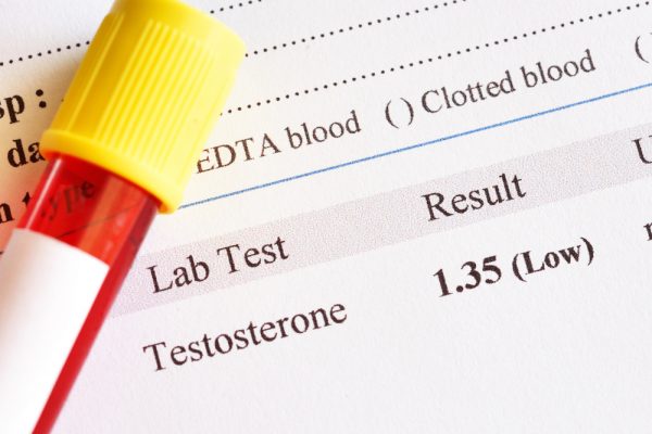 normal testosterone level for men